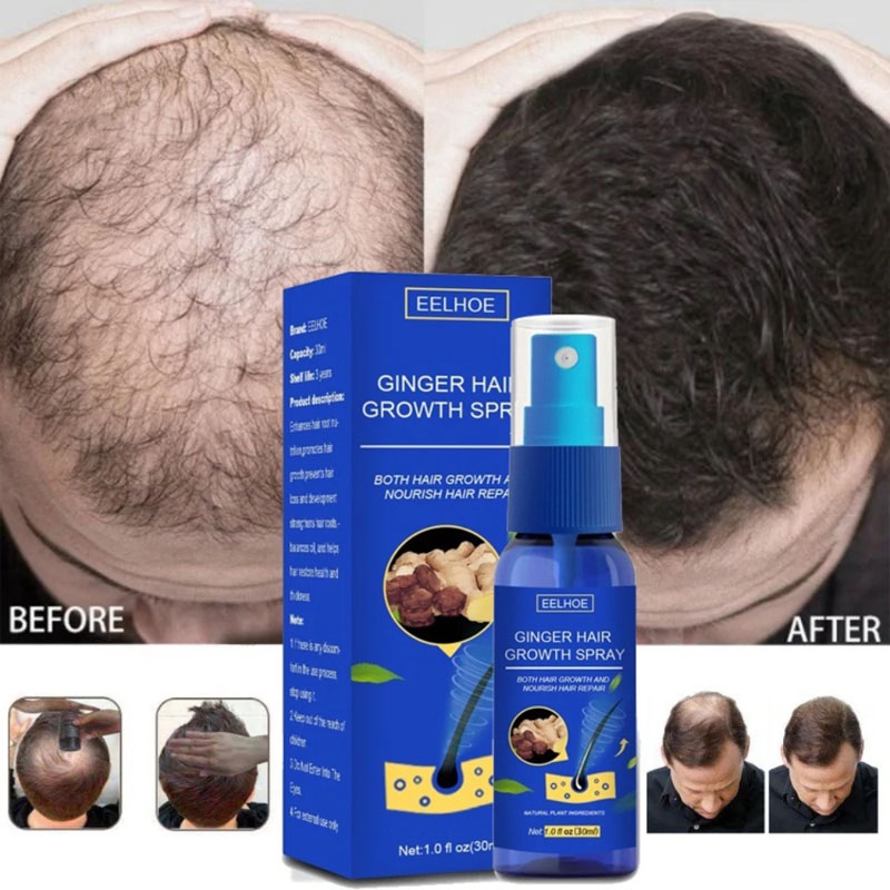 Epidermal Growth Factor - Zencefil Saç Büyüme Serumu Sprey Anti