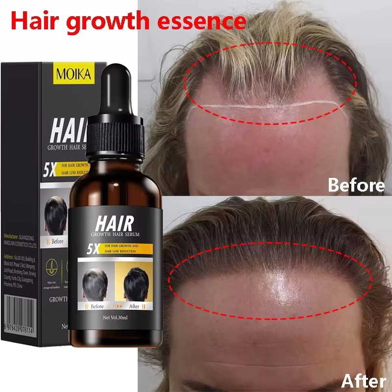 Epidermal Growth Factor - Hızlı Saç Çıkarma Serumu Saç Yeniden