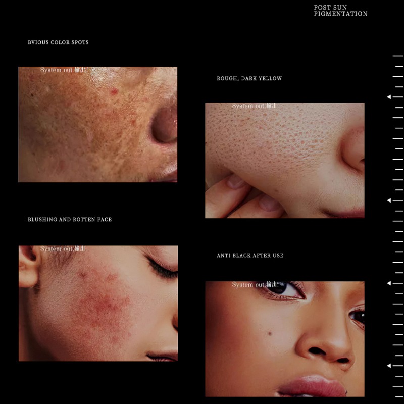 1.94oz Doğal Lüks Niasinamid P - Luxury Glow Skincare incelemesi ve fiyatı