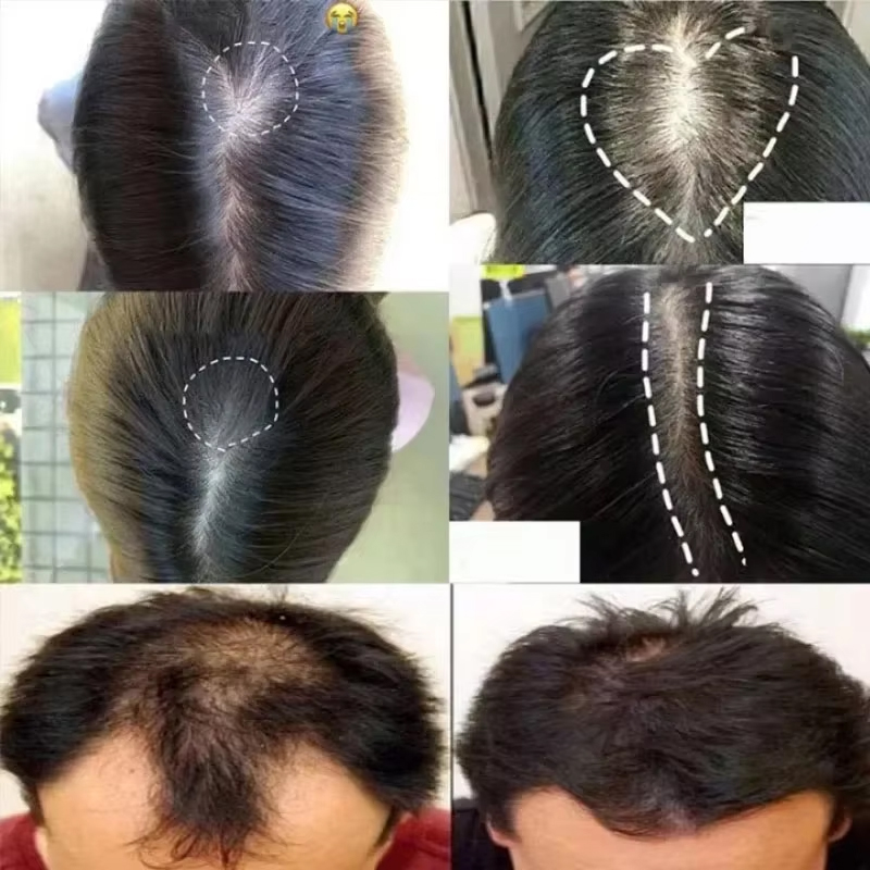 Zencefil Saç Büyüme Serumu Spr - Epidermal Growth Factor incelemesi ve fiyatı