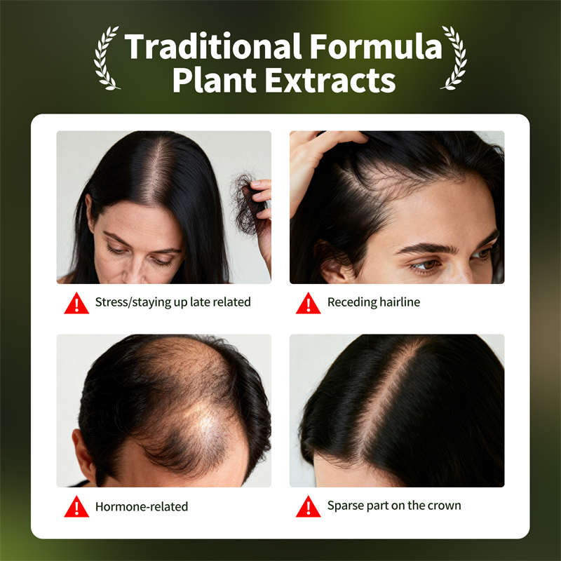 Doğal Saç Çıkarma Seti Usman Ç - Epidermal Growth Factor incelemesi ve fiyatı