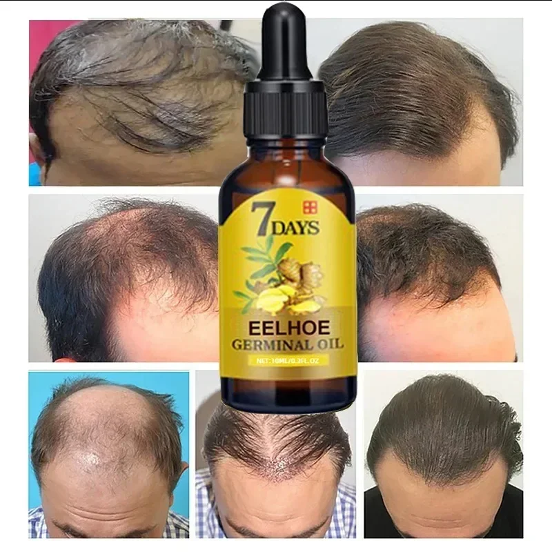 7 gün hızlı saç büyüme yağı ze - Epidermal Growth Factor incelemesi ve fiyatı
