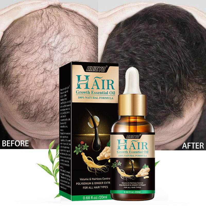 2023 Biotin Hızlı Saç Büyüme Y - Epidermal Growth Factor incelemesi ve fiyatı