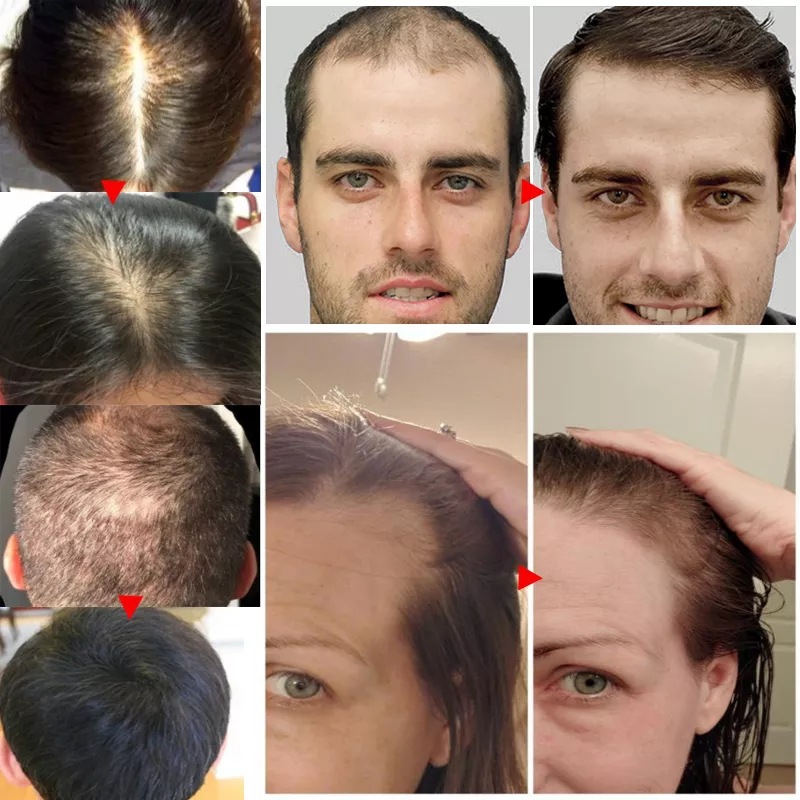 2023 Biotin Hızlı Saç Büyüme Y - Epidermal Growth Factor incelemesi ve fiyatı