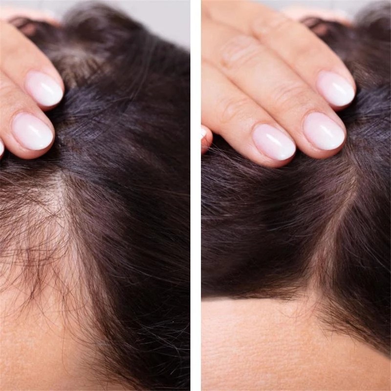 2023 Biotin Hızlı Saç Büyüme Y - Epidermal Growth Factor incelemesi ve fiyatı