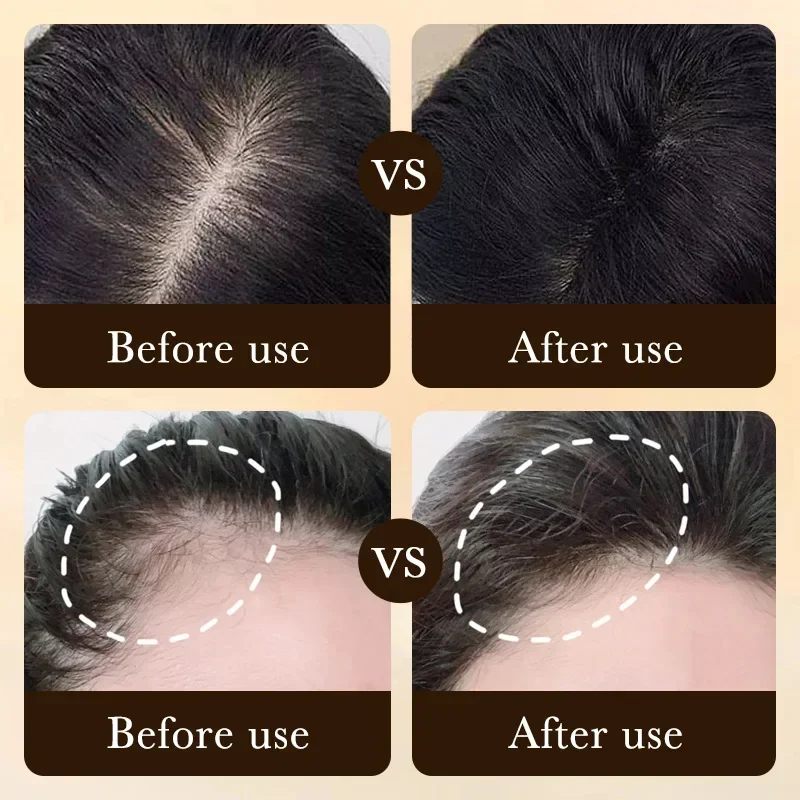 Biotin Hızlı Saç Uzatma Yağı Ü - Epidermal Growth Factor incelemesi ve fiyatı