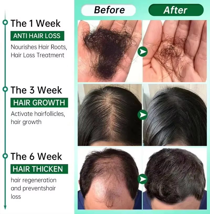 Saç Büyüme Serumu 7 Gün Hızlı  - Epidermal Growth Factor incelemesi ve fiyatı