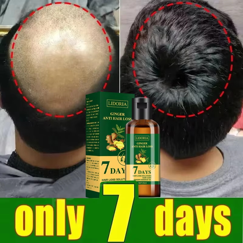 Saç Büyüme Serumu 7 Gün Hızlı  - Epidermal Growth Factor incelemesi ve fiyatı