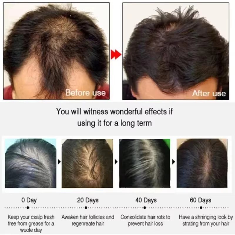 Saç Büyüme Serumu 7 Gün Hızlı  - Epidermal Growth Factor incelemesi ve fiyatı