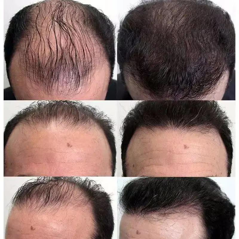 Hızlı Saç Çıkarma Serumu Saç Y - Epidermal Growth Factor incelemesi ve fiyatı