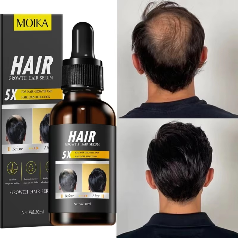 Hızlı Saç Çıkarma Serumu Saç Y - Epidermal Growth Factor incelemesi ve fiyatı