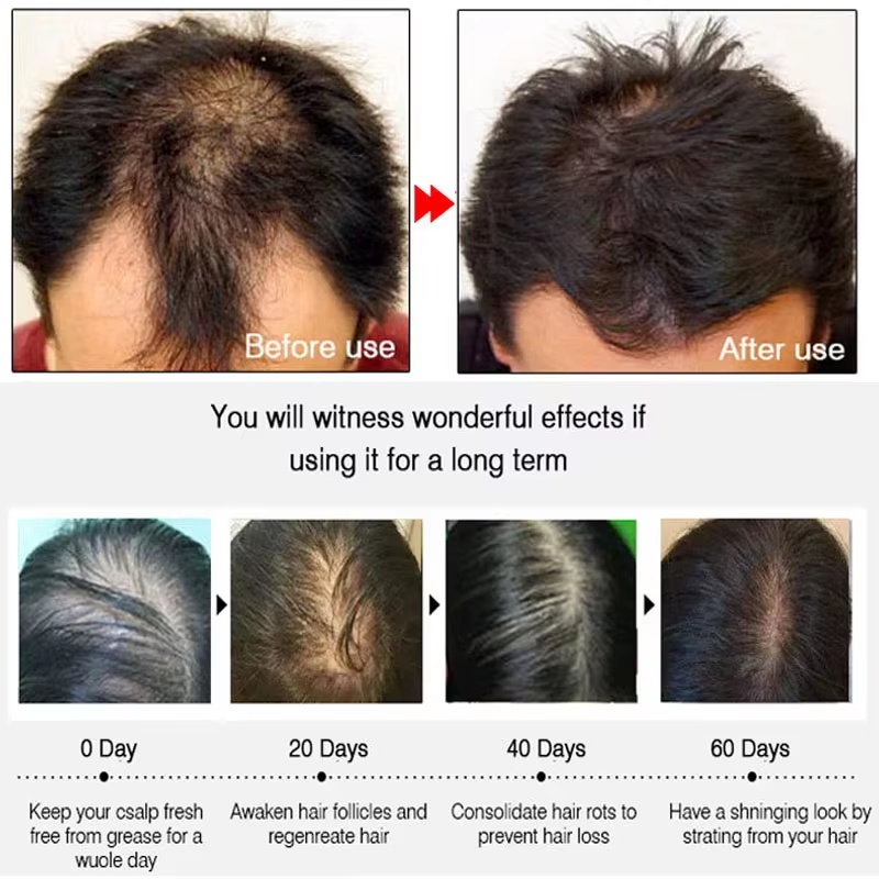 Hızlı Zencefilli Saç Uzatma Sp - Epidermal Growth Factor incelemesi ve fiyatı